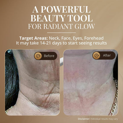 Revitalize Your Skin with the GLO24K LED Face Massager & Neck Wand - The Ultimate Beauty Tool for Radiant Skin